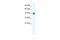 Zinc Finger Protein 551 antibody, A14753, Boster Biological Technology, Western Blot image 