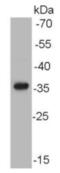 Aldo-Keto Reductase Family 7 Member A2 antibody, NBP2-67126, Novus Biologicals, Western Blot image 