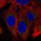 SH2B Adaptor Protein 1 antibody, NBP2-56004, Novus Biologicals, Immunofluorescence image 