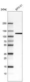 Integrin Subunit Beta 3 antibody, AMAb91470, Atlas Antibodies, Western Blot image 
