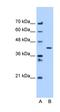 Adipocyte Plasma Membrane Associated Protein antibody, orb325483, Biorbyt, Western Blot image 