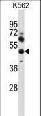 Matrix Metallopeptidase 13 antibody, LS-C164234, Lifespan Biosciences, Western Blot image 