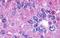Prostaglandin E Receptor 2 antibody, NLS968, Novus Biologicals, Immunohistochemistry paraffin image 