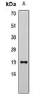 Lipocalin 1 antibody, LS-C668095, Lifespan Biosciences, Western Blot image 