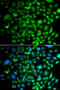Protein Tyrosine Kinase 6 antibody, 22-985, ProSci, Immunofluorescence image 