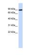 Phosphoglucomutase 2 Like 1 antibody, orb326019, Biorbyt, Western Blot image 