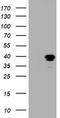MAGE Family Member B1 antibody, LS-C175319, Lifespan Biosciences, Western Blot image 