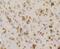 Receptor For Activated C Kinase 1 antibody, A02145-1, Boster Biological Technology, Immunohistochemistry paraffin image 