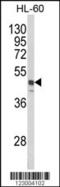 Sorting nexin-6 antibody, 57-884, ProSci, Western Blot image 