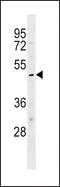 Potassium Voltage-Gated Channel Subfamily J Member 10 antibody, LS-C159975, Lifespan Biosciences, Western Blot image 