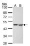 KRR1 Small Subunit Processome Component Homolog antibody, PA5-21693, Invitrogen Antibodies, Western Blot image 