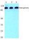 Phospholipase D2 antibody, PA5-36868, Invitrogen Antibodies, Western Blot image 