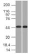 TIMP Metallopeptidase Inhibitor 2 antibody, orb388717, Biorbyt, Western Blot image 