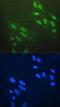 Zinc Finger E-Box Binding Homeobox 1 antibody, A00548-2, Boster Biological Technology, Immunofluorescence image 