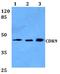 Cyclin Dependent Kinase 9 antibody, A00794-1, Boster Biological Technology, Western Blot image 