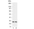 Peptidylprolyl Isomerase A antibody, R30519, NSJ Bioreagents, Western Blot image 