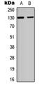 Integrin Subunit Alpha E antibody, abx121562, Abbexa, Western Blot image 