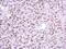 High Mobility Group Box 1 antibody, GTX628834, GeneTex, Immunohistochemistry paraffin image 