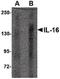 Pro-interleukin-16 antibody, PA5-20671, Invitrogen Antibodies, Western Blot image 