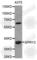 Sprouty RTK Signaling Antagonist 2 antibody, A6262, ABclonal Technology, Western Blot image 