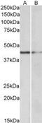 GATA Binding Protein 3 antibody, MBS421671, MyBioSource, Western Blot image 