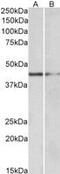 GATA Binding Protein 3 antibody, MBS421671, MyBioSource, Western Blot image 