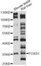 Forkhead Box S1 antibody, LS-C749715, Lifespan Biosciences, Western Blot image 