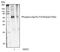 Zeta Chain Of T Cell Receptor Associated Protein Kinase 70 antibody, MA5-28070, Invitrogen Antibodies, Western Blot image 
