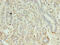 Kelch Like ECH Associated Protein 1 antibody, CSB-PA012147LA01HU, Cusabio, Immunohistochemistry paraffin image 