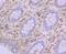 Glucose-6-Phosphate Isomerase antibody, NBP2-76840, Novus Biologicals, Immunohistochemistry paraffin image 
