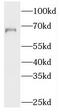 Syncoilin, Intermediate Filament Protein antibody, FNab08433, FineTest, Western Blot image 