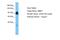 Scm Like With Four Mbt Domains 1 antibody, A30288, Boster Biological Technology, Western Blot image 