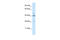 Ceramide Synthase 3 antibody, 27-383, ProSci, Enzyme Linked Immunosorbent Assay image 