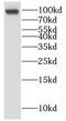 KN motif and ankyrin repeat domain-containing protein 2 antibody, FNab04465, FineTest, Western Blot image 