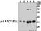 Linker For Activation Of T Cells antibody, A01654Y191, Boster Biological Technology, Western Blot image 