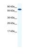 CBFA2/RUNX1 Partner Transcriptional Co-Repressor 2 antibody, orb324713, Biorbyt, Western Blot image 