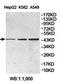 F-Box And WD Repeat Domain Containing 12 antibody, orb78441, Biorbyt, Western Blot image 
