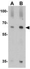 Quiescin Sulfhydryl Oxidase 1 antibody, GTX31618, GeneTex, Western Blot image 