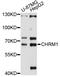 Acetylcholine Receptor antibody, LS-C747448, Lifespan Biosciences, Western Blot image 