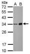 Chymotrypsin Like Elastase 3B antibody, PA5-29659, Invitrogen Antibodies, Western Blot image 