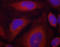 Synaptotagmin 1 antibody, TA333297, Origene, Immunofluorescence image 