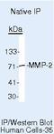 Matrix Metallopeptidase 2 antibody, MA5-14183, Invitrogen Antibodies, Immunoprecipitation image 