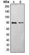 Frizzled Class Receptor 6 antibody, LS-C353046, Lifespan Biosciences, Western Blot image 