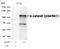 Catenin Alpha 1 antibody, GTX50338, GeneTex, Western Blot image 