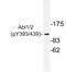 ABL Proto-Oncogene 1, Non-Receptor Tyrosine Kinase antibody, LS-C178006, Lifespan Biosciences, Western Blot image 