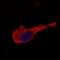 Neurofilament Medium antibody, NB500-446, Novus Biologicals, Immunocytochemistry image 