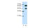Small Nuclear Ribonucleoprotein U1 Subunit 70 antibody, 29-302, ProSci, Western Blot image 