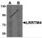 Leucine Rich Repeat Transmembrane Neuronal 4 antibody, 6173, ProSci, Western Blot image 