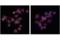 Transmembrane Protein 173 antibody, 62912S, Cell Signaling Technology, Immunocytochemistry image 