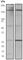 Rho Associated Coiled-Coil Containing Protein Kinase 1 antibody, ab45171, Abcam, Western Blot image 